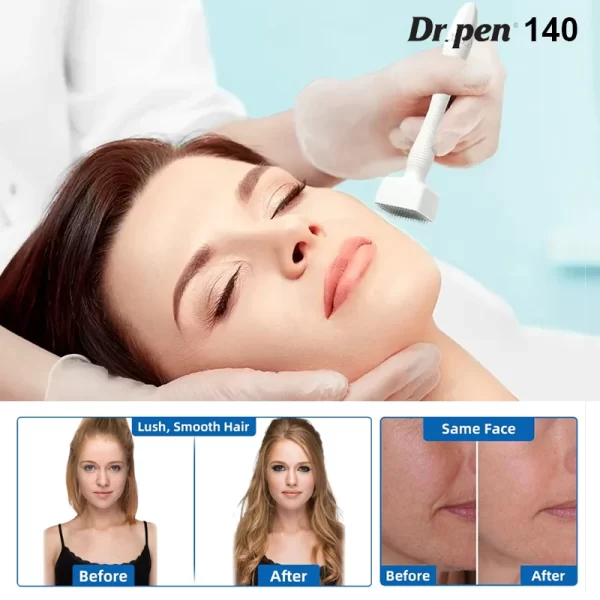 DRS® 140 Derma Stamp for hair grown
