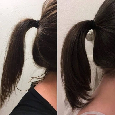 Microneedling Vorher Nachher bei Stärkt das Haarwachstum
