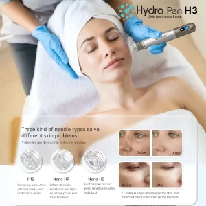Hydra Pen H3 Microneedling Infusion by Dr Pen Official