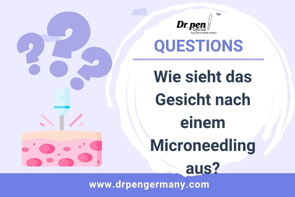 Wie sieht das Gesicht nach einem Microneedling aus ? - Dr Pen original website