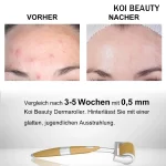 KOI BEAUTY Derma Roller 1mm für Haarwachstum Zuhause